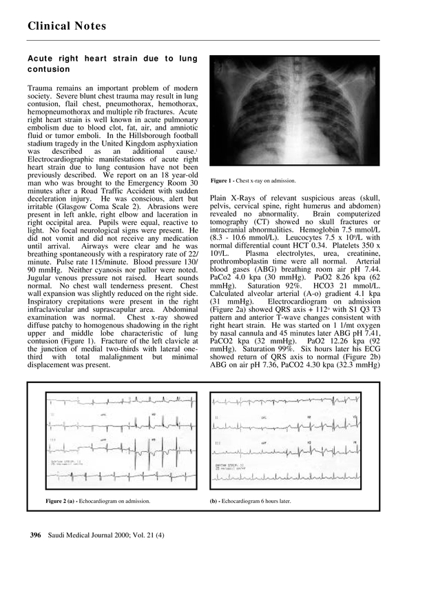 PDF extract preview